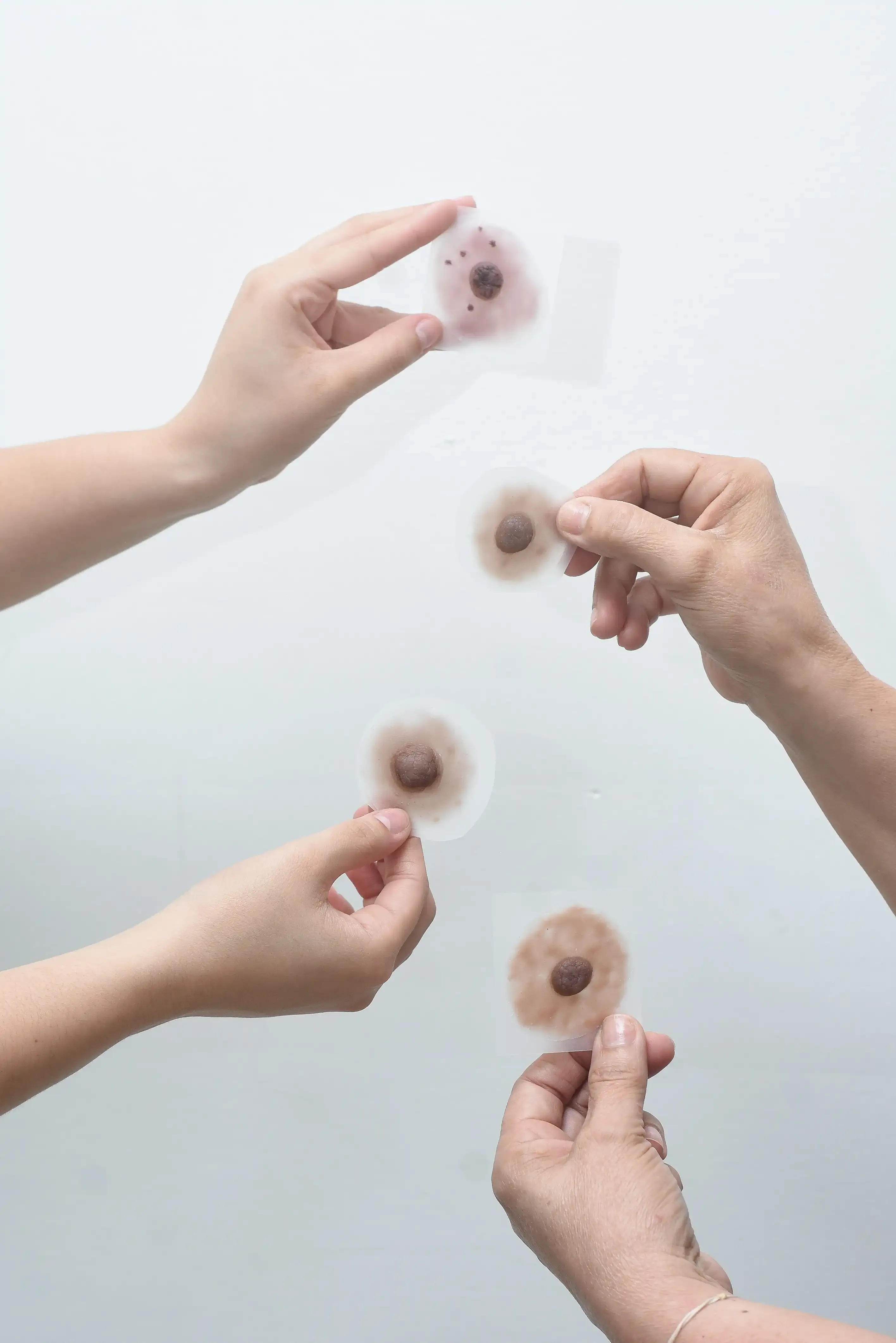 Prótesis Almare - detalle 1