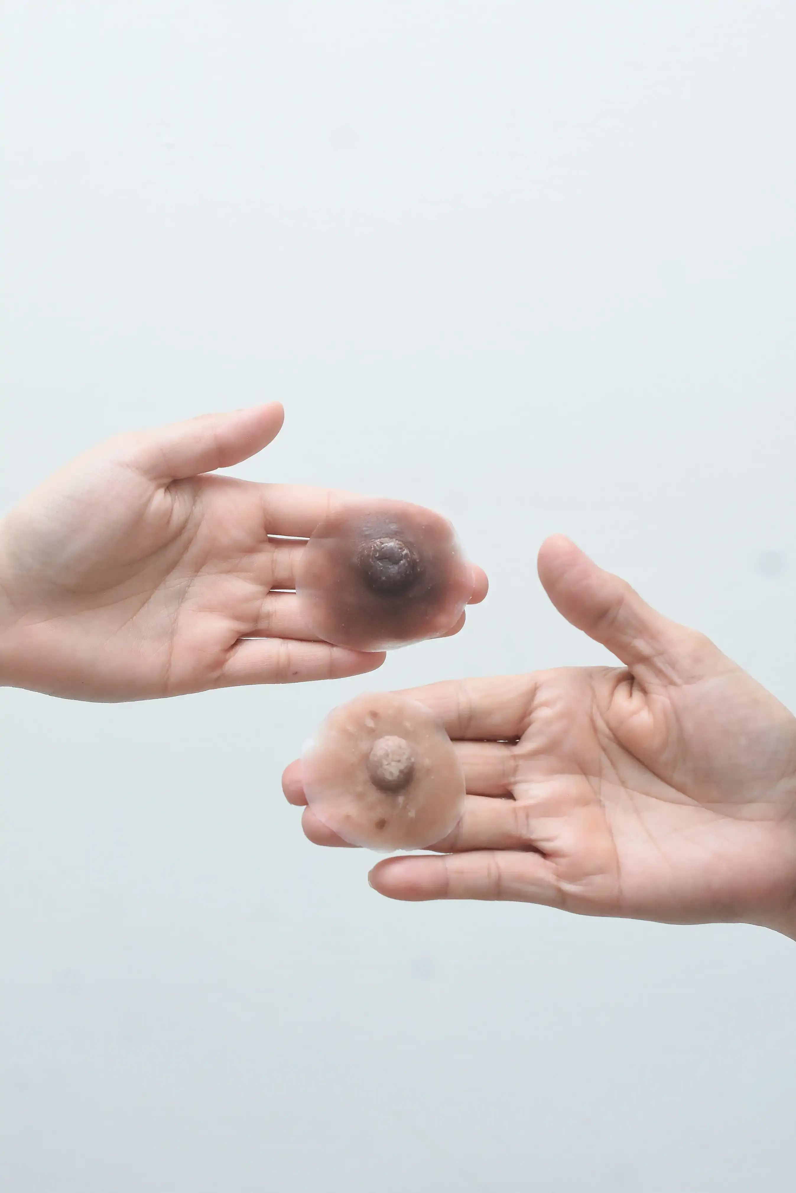 Prótesis Almare - detalle 4