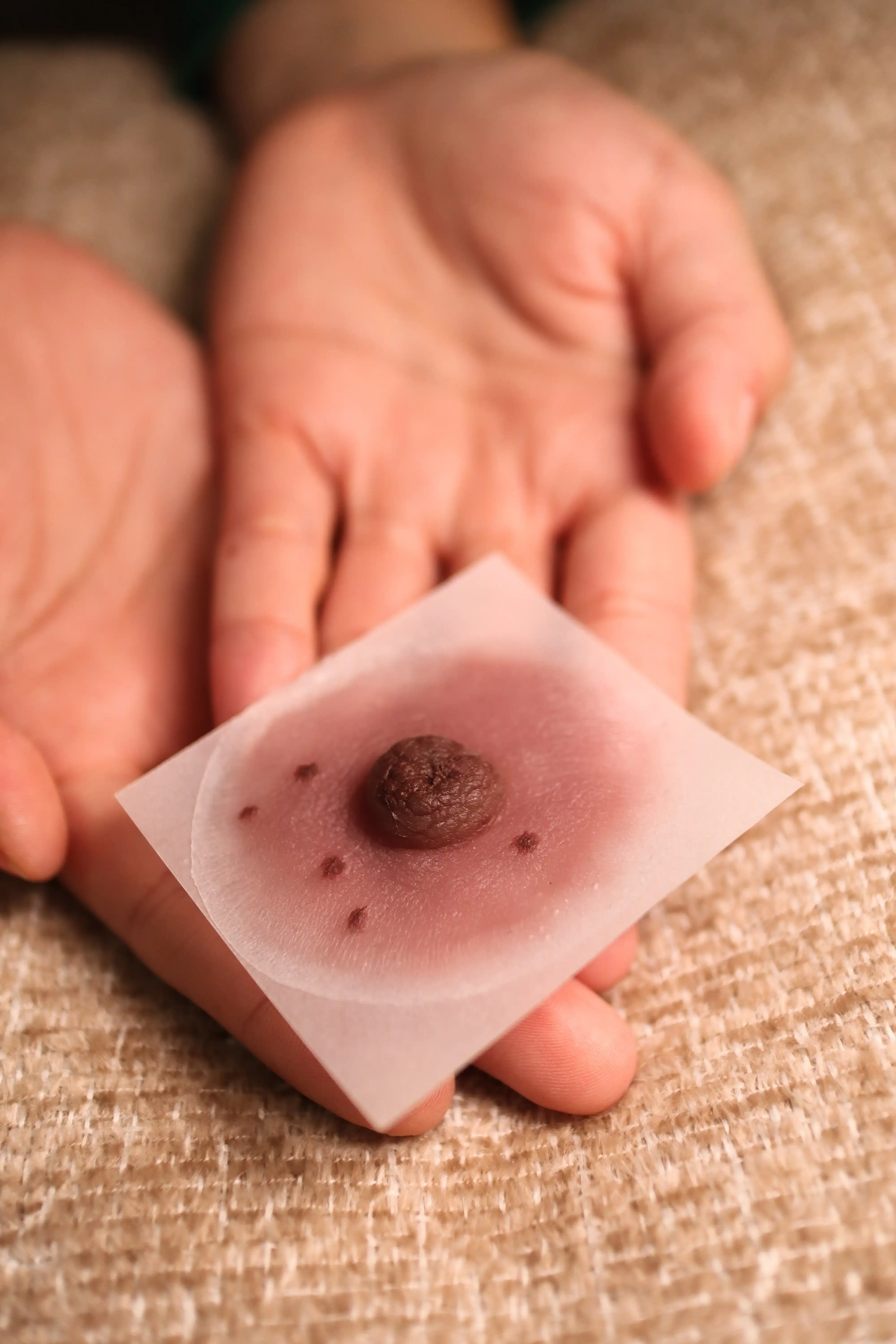 Prótesis Almare - detalle 9